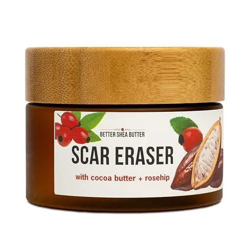Better Shea Butter Scar Eraser Balm with shea and cocoa butter for scars