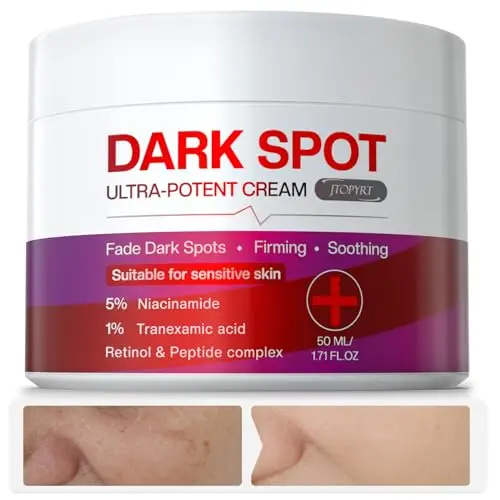 Jtopyrt Dark Spot Cream tube with brightening treatment text